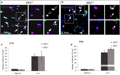 Slit1 Protein Regulates SVZ-Derived Precursor Mobilization in the Adult Demyelinated CNS